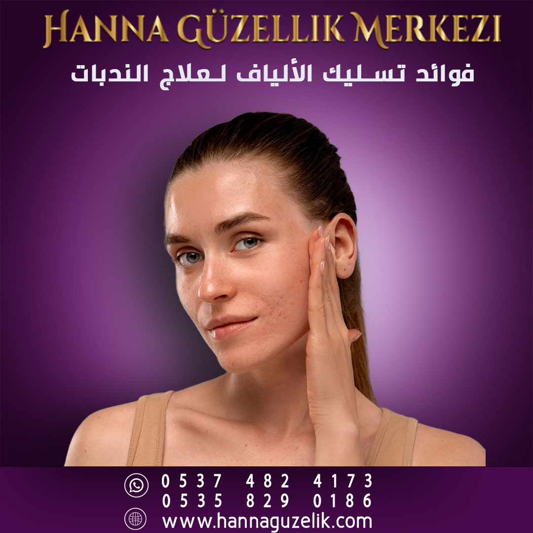 فوائد علاج الندبات عن طريق تسليك الألياف