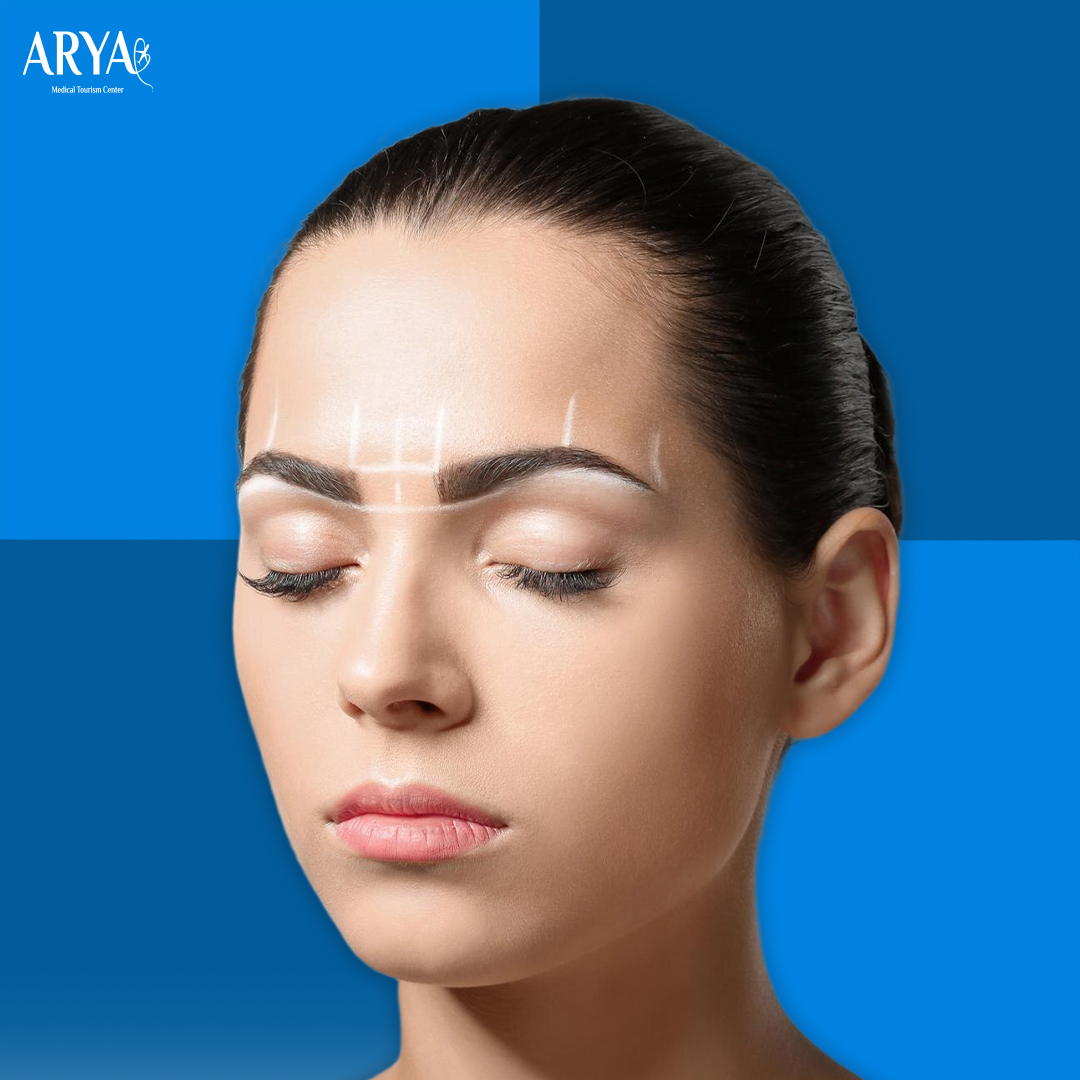 Eyebrow Transplantation